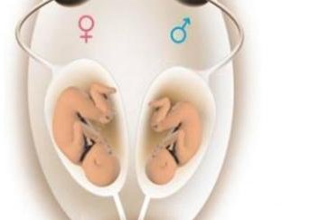 子宫畸形试管婴儿双胞胎容易畸形吗？